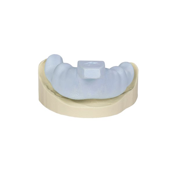 Ultimaker 2+ Connect Dental-Paket